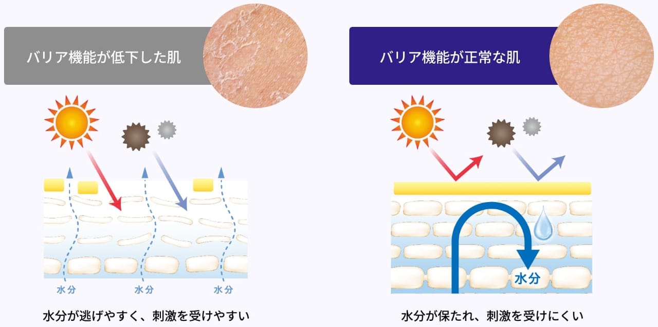 バリア機能の役割は保湿と保護！