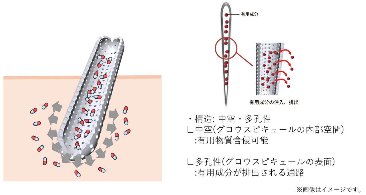 独自技術グロウスピキュール