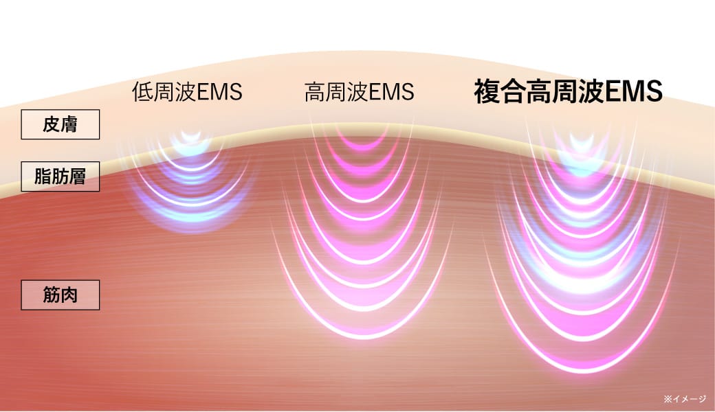 EMS(5 〜 100kHz)