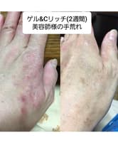 ┃完売┃【お得なC&Gセット】イフェオン エンリッチゲル 180g+シーリッチ 12ml