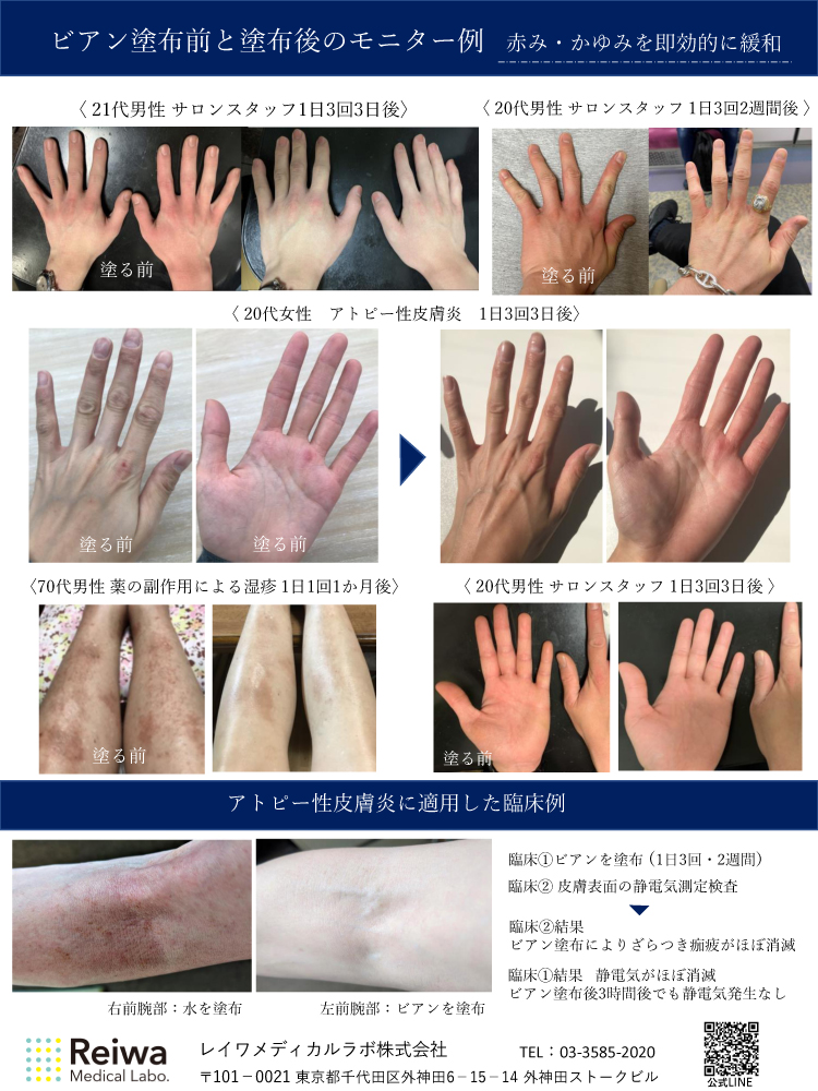 ビアン ハンドオイル 15mlの業務用通販サイト B Zone